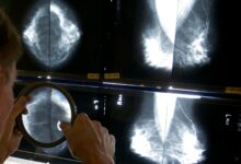 Photo of Controles claves: estos son los estudios para la detección temprana del cáncer que sí nos dan ventaja contra la enfermedad