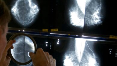 Photo of Controles claves: estos son los estudios para la detección temprana del cáncer que sí nos dan ventaja contra la enfermedad