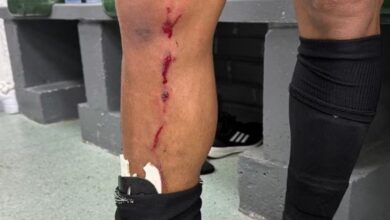 Photo of Video: el brutal planchazo al argentino Cuello