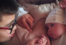 Photo of “Sonreír por pequeñas cosas”: su beba nació con un síndrome poco frecuente, pero encontraron el camino para ayudarla a crecer