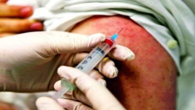 Photo of Alerta sanitaria por cuatro brotes activos de sarampión y 500 casos bajo investigación